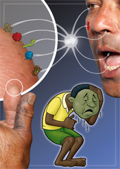 Germ sickness